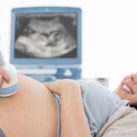cropped image of doctor performing ultrasound on pregnant woman in clinic 